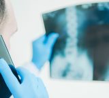 man looking at xray