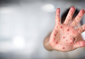 post thumbnail images